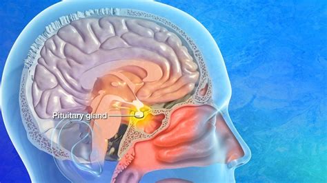 transsphenoidal pituitary tumor biopsy